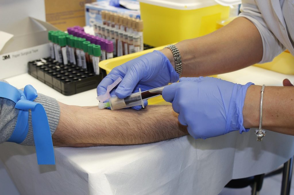 Analys av en studie om sjuksköterskors arbetsbelastning på belgiska akutmottagningar och dess påverkan på patientsäkerhet och flöde